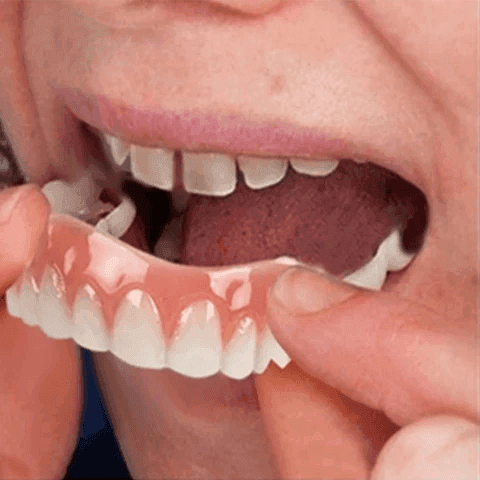 Dentadura Universal NewSmile Ajustável, Discreta e Confortável - Kit Prótese Dental Completa - Compre 1 e Leve 2